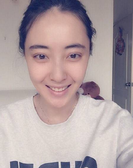 米露個人資料大揭秘 米露臉上有疤是怎么回事