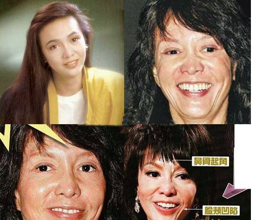 鄭裕玲整容前后照片嚇?biāo)廊?鄭裕玲個人資料曝光
