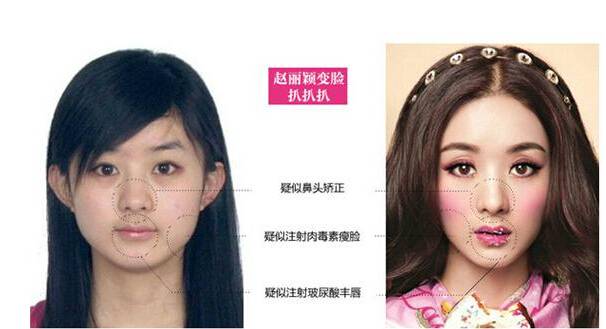 揭趙麗穎罵楊冪真相 趙麗穎整容前后對比