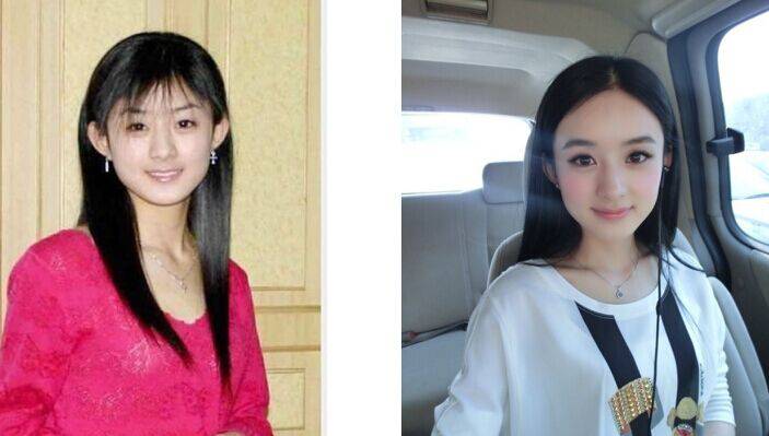 趙麗穎整容了嗎 趙麗穎的男朋友是誰(shuí)