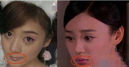 揭袁姍姍整容前后照片 與楊冪美貌事業(yè)大PK