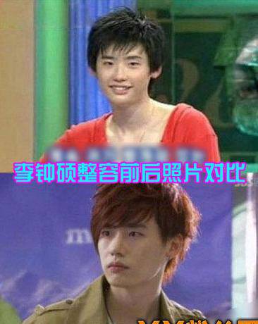 李鐘碩個人資料外泄 李鐘碩承認(rèn)整容只瘦臉隆鼻