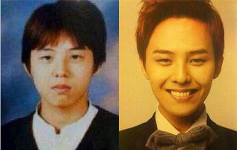 崔勝賢整容前后照片對比 Bigbang成員整容