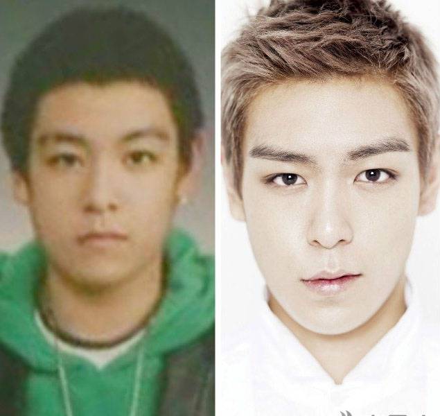 崔勝賢整容前后照片對比 Bigbang成員整容