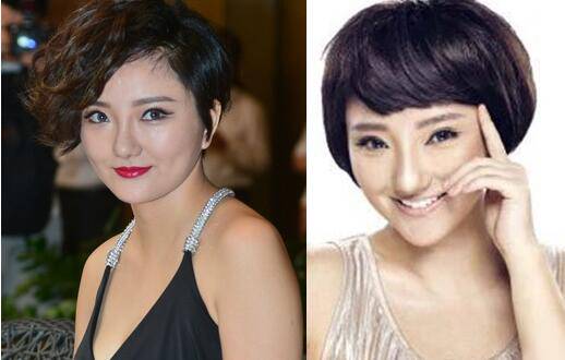 柳巖終于承認(rèn)整容了 娛樂圈都有誰整了