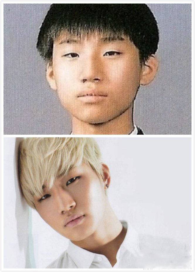 崔勝賢整容前后照片對比 Bigbang成員整容