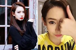 戚薇日本拍戲受傷 需做面部縫針手術