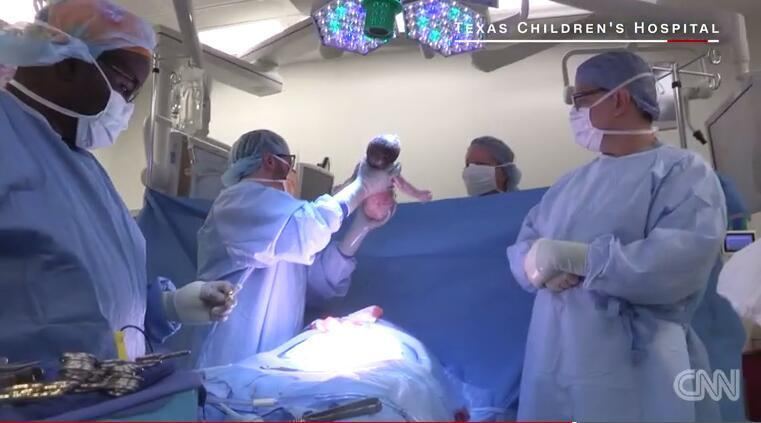 胎兒23周被取出子宮 手術(shù)后放回32周健康出生