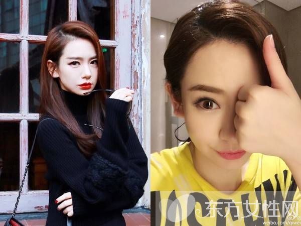 戚薇日本拍戲受傷 需做面部縫針手術(shù)