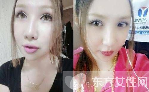 徐彎彎微博爆料黃海波嫖娼視頻 整容前模樣驚人