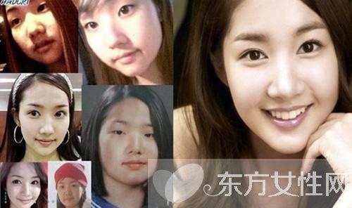 樸敏英整容前后照曝光 樸敏英三次大變身