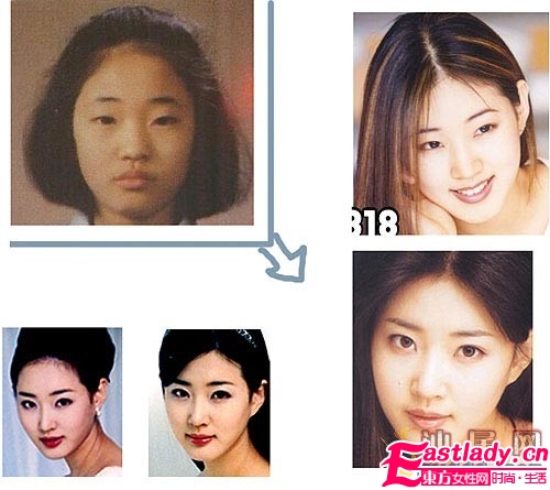 金莎朗整容前后對比照 金莎朗整容了嗎