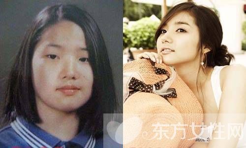 樸敏英整容前后照曝光 樸敏英三次大變身