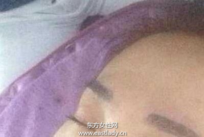 丫蛋整容前后對比照曝光