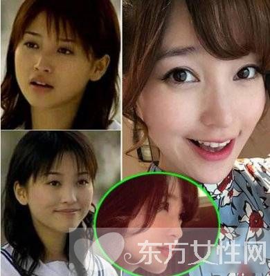 金莎個(gè)人資料曝光 歌手金莎大方承認(rèn)整容