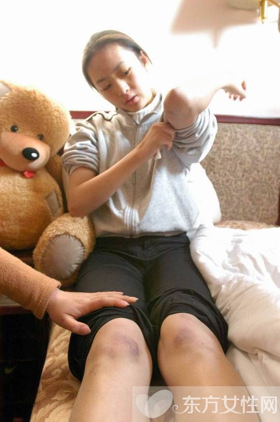 張默打傷女友童瑤事件始末 童謠個(gè)人資料