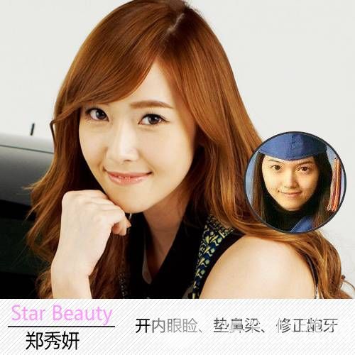 鄭秀妍個人資料 鄭秀妍整容前后照曝光