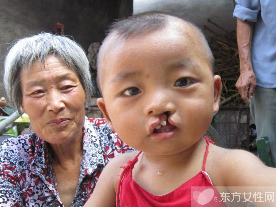 李嫣兔唇原因 李嫣護姐對抗網(wǎng)友獲贊 中國好姐妹