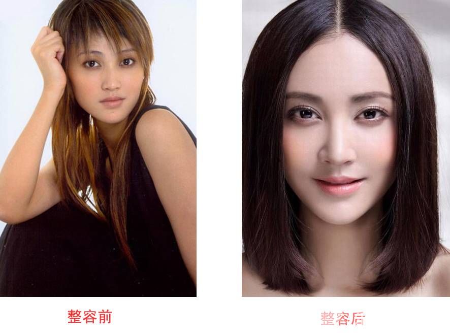 張歆藝整容前后對(duì)比驚人 揭張歆藝與前夫楊樹鵬離婚內(nèi)幕