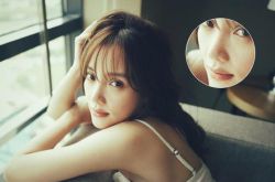 李小璐整容失敗變臉癱 老公賈乃亮力挺愛妻否認整容