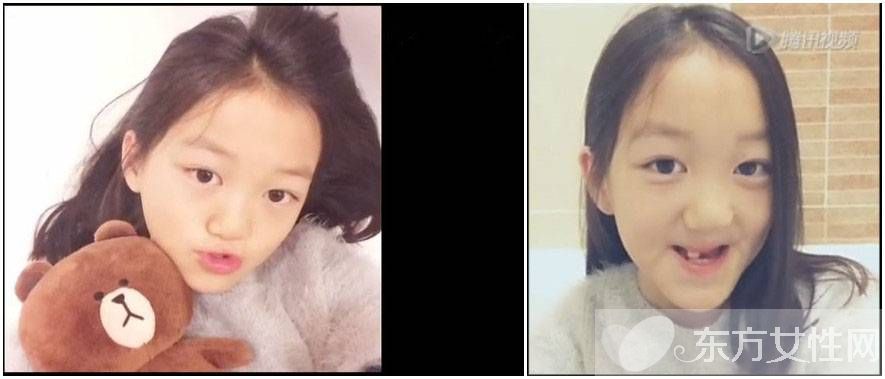 李嫣兔唇原因 李嫣護姐對抗網(wǎng)友獲贊 中國好姐妹