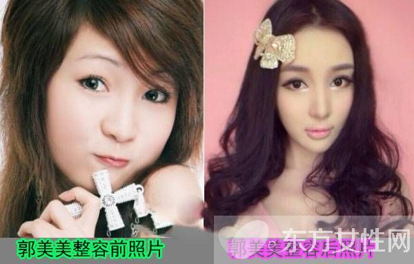 炫富女郭美美是誰(shuí) 郭美美與干爹王軍激戰(zhàn)圖遭曝光