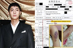 金賢重女友崔某照片 金賢重私生活混亂形象一去不復(fù)返