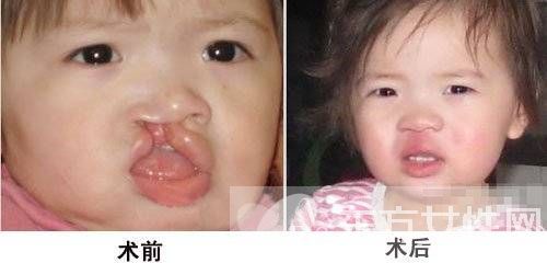 李嫣兔唇原因 李嫣護姐對抗網(wǎng)友獲贊 中國好姐妹