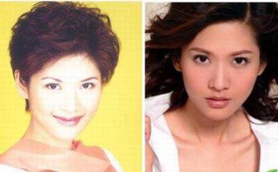 鳳凰女主播沈星慘遭整容失敗 沈星整容前后照片