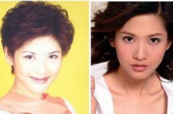 鳳凰女主播沈星慘遭整容失敗 沈星整容前后照片