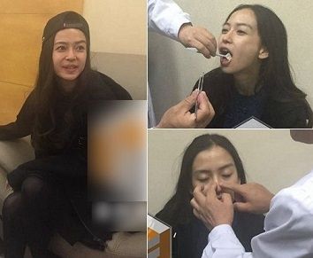 angelababy為何做整容鑒定 不想孩子看到報道蒙受委屈