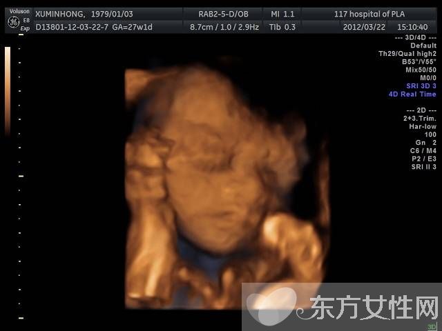 三維b超什么時候做 這些B超誤區(qū)有多少媽媽知道