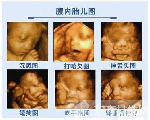 三維b超什么時候做 這些B超誤區(qū)有多少媽媽知道