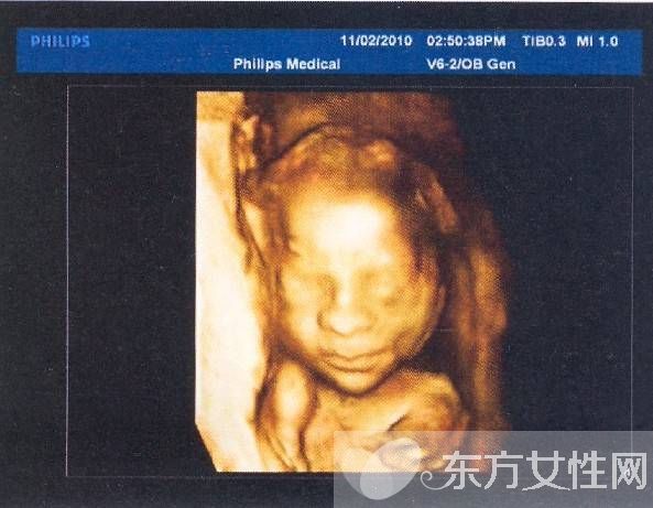 三維b超什么時候做 這些B超誤區(qū)有多少媽媽知道