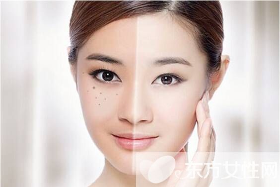 產(chǎn)后黃褐斑怎么去掉 這些方法試過的都說好