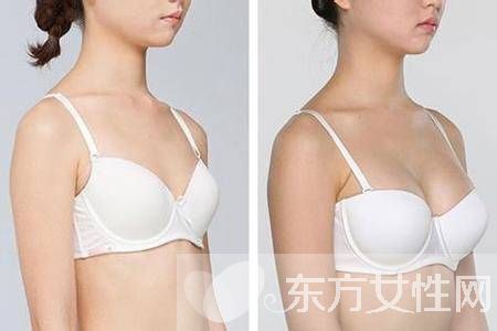 產(chǎn)后胸部下垂怎么辦 只需六招便能重新力挺起來