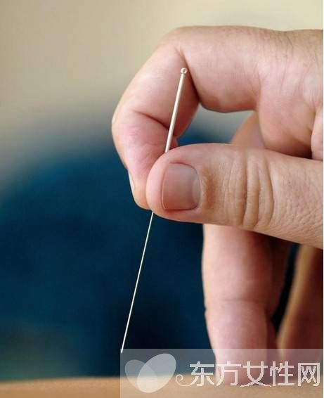 針灸減肥誤區(qū)須知 針灸減肥的副作用有哪些