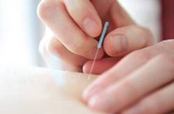 針灸減肥誤區(qū)須知 針灸減肥的副作用有哪些