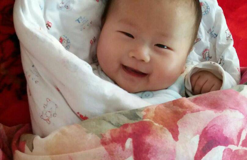 寶寶臉上長廯怎么辦 這些一定要注意