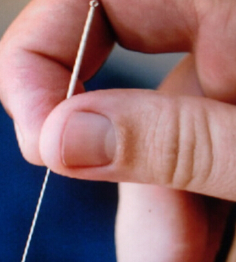 針灸減肥 針灸減肥十大常見問題