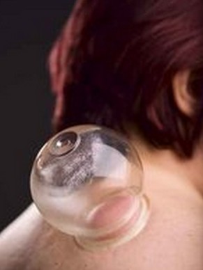 拔罐減肥 中醫(yī)詳解拔罐操作方法及注意事項(xiàng)