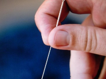 針灸減肥原理 針灸減肥反彈的快嗎