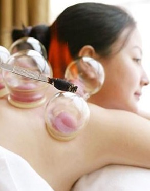 拔罐減肥方法 拔罐減肥的禁忌及注意事項