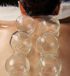 拔罐減肥原理 中醫(yī)拔罐減肥效果及適用人群