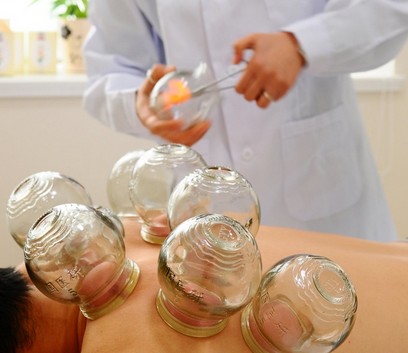 拔罐減肥的方法 拔罐減肥的作用和操作方法