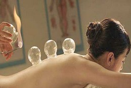 拔罐減肥的方法 拔罐減肥的作用和操作方法