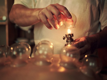 拔罐減肥 拔罐減肥的利與弊