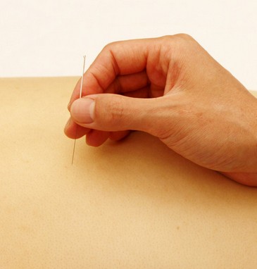 針灸減肥的原理 調整內分泌失調