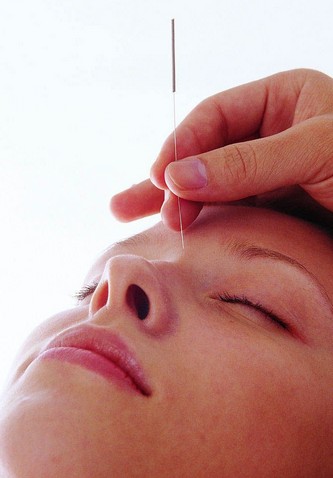 針灸減肥副作用 針灸減肥治內(nèi)分泌失調(diào)