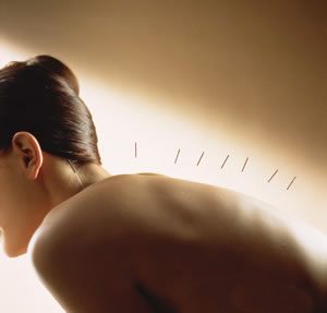 如何健康減肥 中醫(yī)針灸減肥的優(yōu)勢有哪些